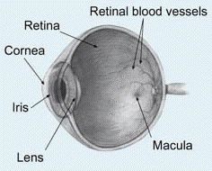 eye problems - macular degeneration