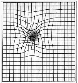 Amsler grid showing macular degeneration at Master Eye Associates Austin TX