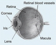 Eye diagram showing the cornea, the location of keratoconus eye problems.
