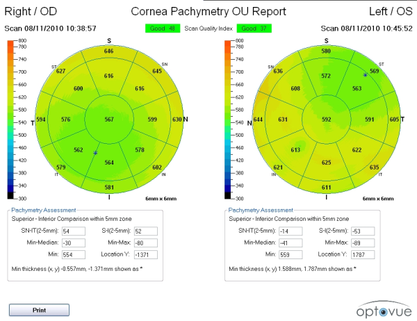 OCT_Pachymetry_Report_Master_Eye_Associates_Austin,_Texas_Dr_J._R._Lacey-resized-600